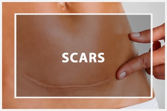 Alternative and Holistic Practitioner Middleton WI Scars